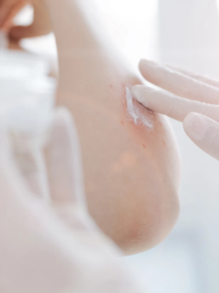 derma.webp