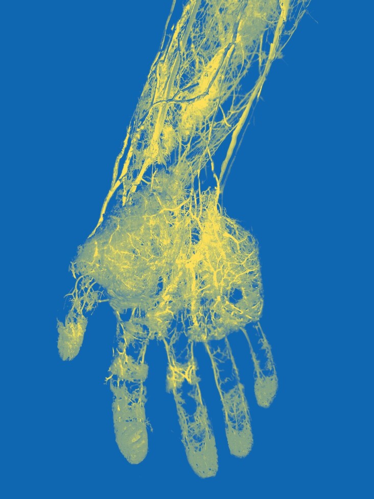 jj-bodyillustration-interior-vascular-hand-colorway02.jpg