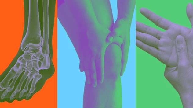 Arthritis collage .webp