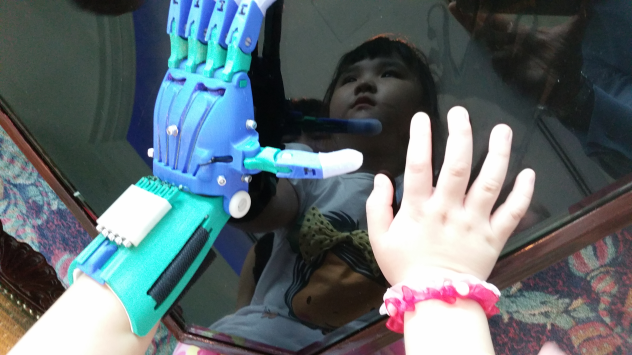A photo of Kai Lei showing her 3-D printed left hand and natural right hand