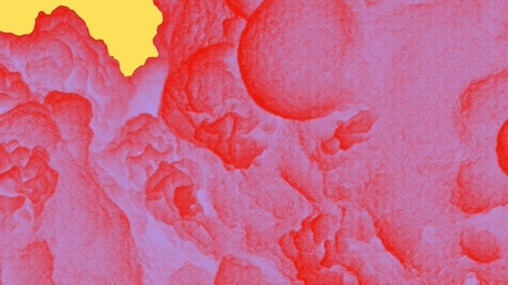 jj-bodyillustration-microscopic-leukemiawhitebloodcells-colorway02.jpg