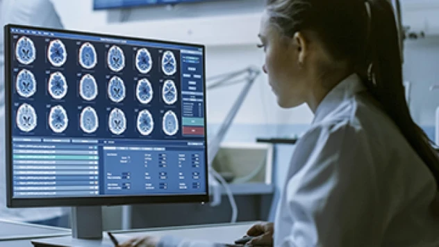 Brain scan.webp