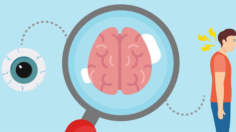 What It Really Feels Like to Have Multiple Sclerosis: changes to the brain, vision, and Lhermitte's sign