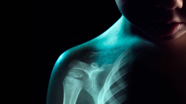 Image of young child with skeleton overlay