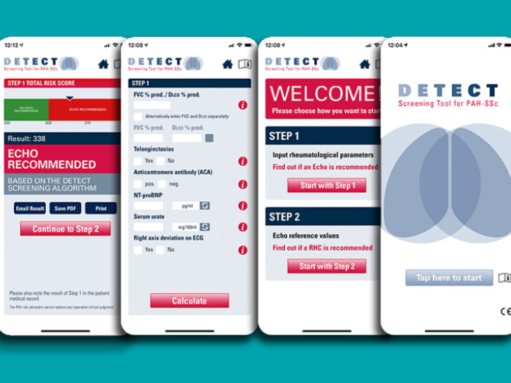Detect Score 3 Tools to Help with Pulmonary Arterial Hypertension Diagnosis
