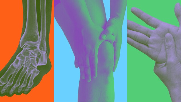 The three main Arthritis types — Rheumatoid, Psoriatic, and Osteoarthritis