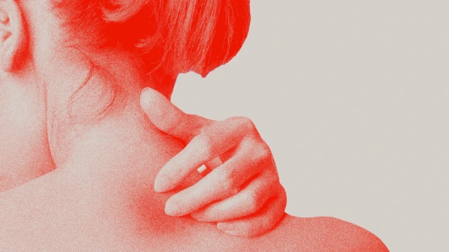Atopic derm.webp
